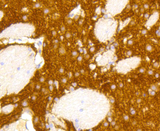 mGluR5 Antibody in Immunohistochemistry (Paraffin) (IHC (P))