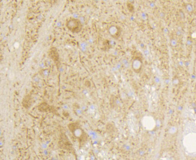 mGluR5 Antibody in Immunohistochemistry (Paraffin) (IHC (P))