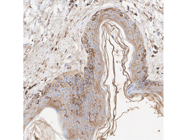 Vitronectin Antibody in Immunocytochemistry (ICC/IF)