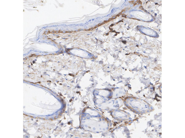 Vitronectin Antibody in Immunocytochemistry (ICC/IF)