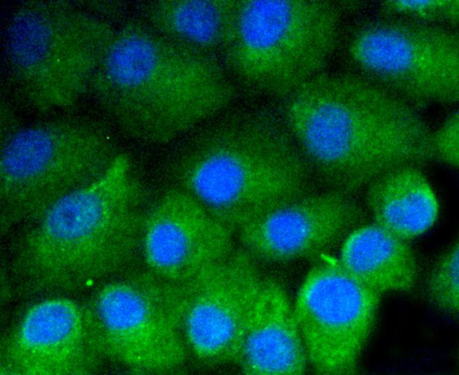 Vitronectin Antibody in Immunocytochemistry (ICC/IF)