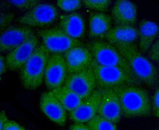 Vitronectin Antibody in Immunocytochemistry (ICC/IF)