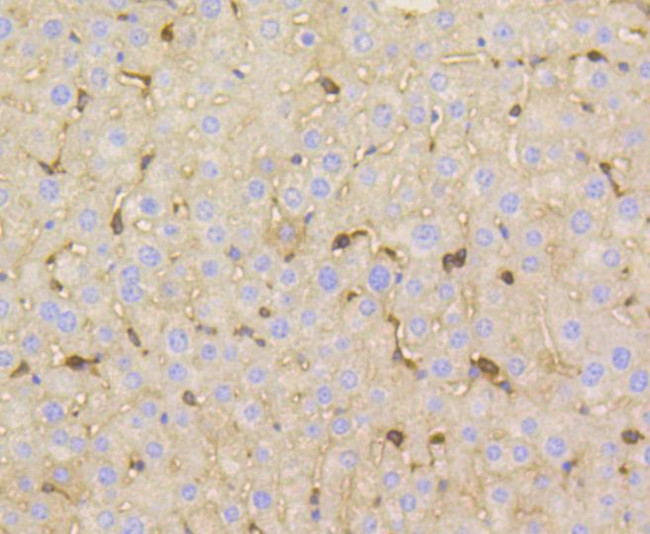 Vitronectin Antibody in Immunohistochemistry (Paraffin) (IHC (P))