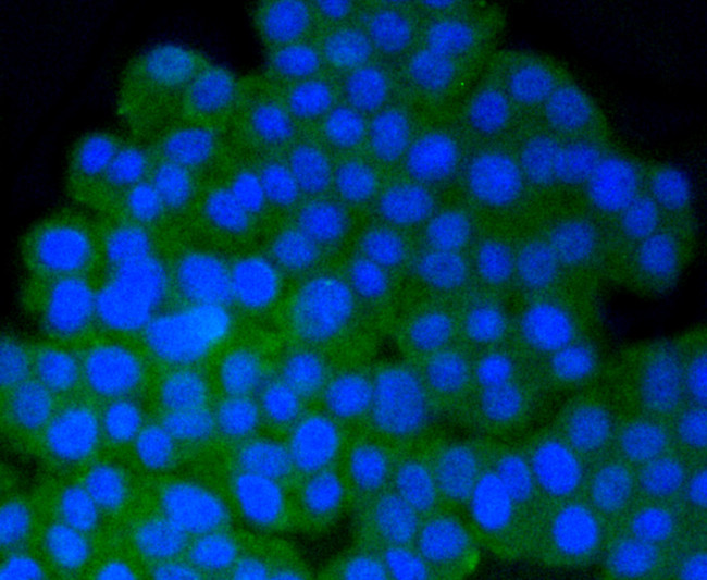 Phospho-PP2A alpha (Tyr307) Antibody in Immunocytochemistry (ICC/IF)