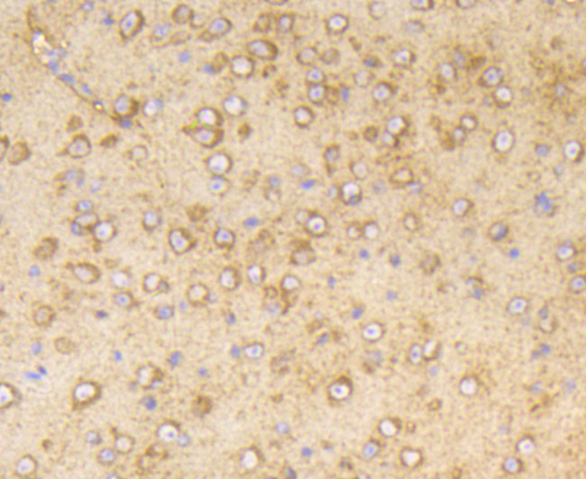 Phospho-PP2A alpha (Tyr307) Antibody in Immunohistochemistry (Paraffin) (IHC (P))