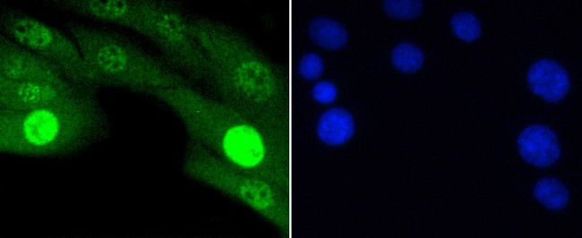 Phospho-JNK1/JNK2/JNK3 (Thr183, Thr221) Antibody in Immunocytochemistry (ICC/IF)