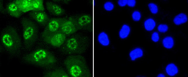 Phospho-JNK1/JNK2/JNK3 (Thr183, Thr221) Antibody in Immunocytochemistry (ICC/IF)