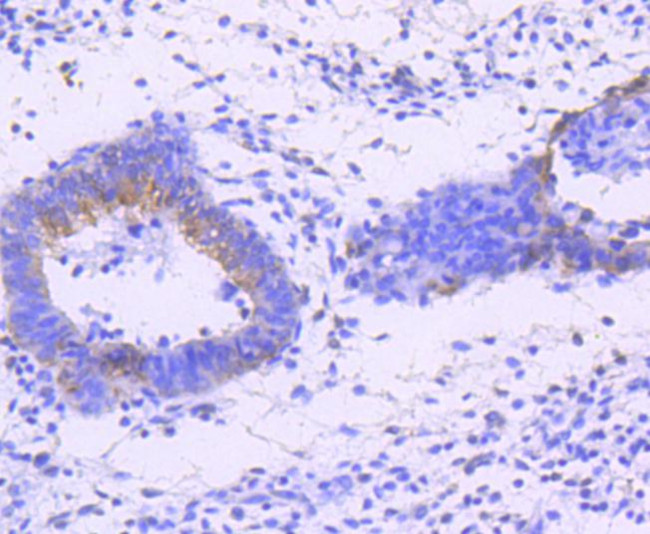 Phospho-JNK1/JNK2/JNK3 (Thr183, Thr221) Antibody in Immunohistochemistry (Paraffin) (IHC (P))