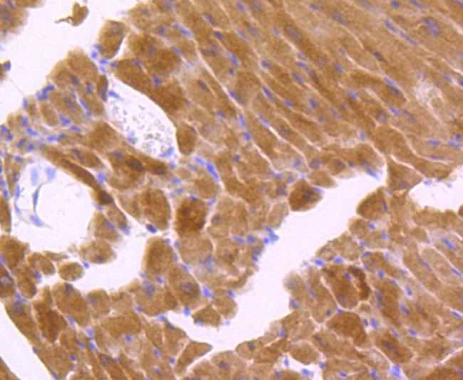 Phospho-JNK1/JNK2/JNK3 (Thr183, Thr221) Antibody in Immunohistochemistry (Paraffin) (IHC (P))