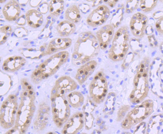 PRMT5 Antibody in Immunohistochemistry (Paraffin) (IHC (P))