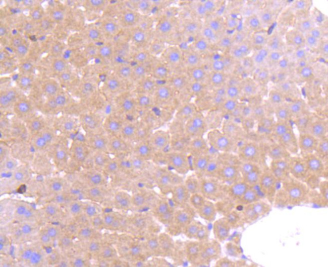 PRMT5 Antibody in Immunohistochemistry (Paraffin) (IHC (P))