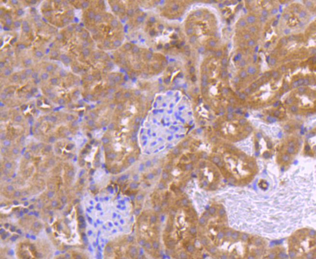 PRMT5 Antibody in Immunohistochemistry (Paraffin) (IHC (P))