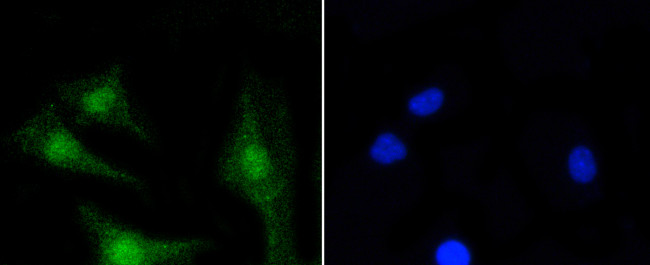 PKC beta-2 Antibody in Immunocytochemistry (ICC/IF)