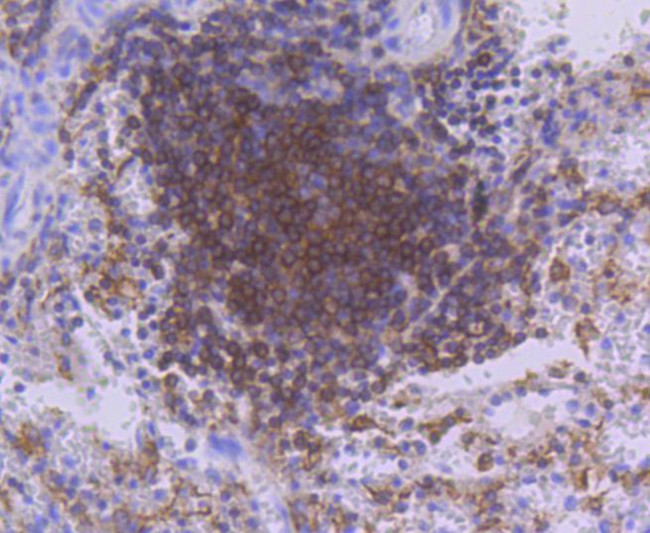 PKC beta-2 Antibody in Immunohistochemistry (Paraffin) (IHC (P))