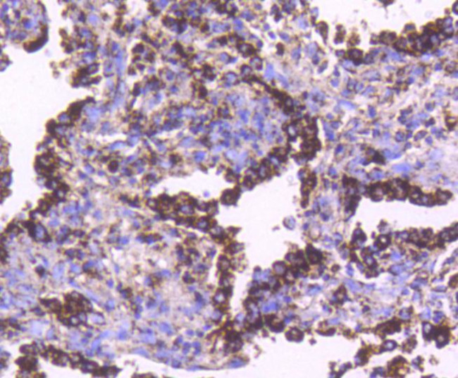 HSP60 Antibody in Immunohistochemistry (Paraffin) (IHC (P))