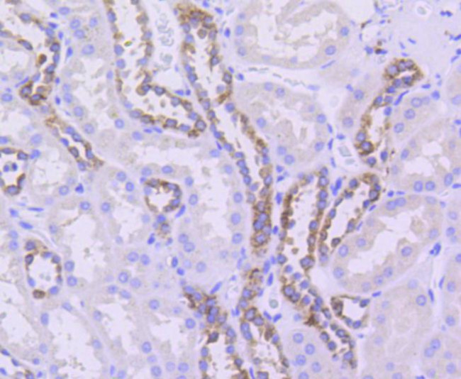 beta Tubulin 2,4 Antibody in Immunohistochemistry (Paraffin) (IHC (P))