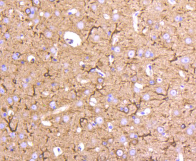 beta Tubulin 2,4 Antibody in Immunohistochemistry (Paraffin) (IHC (P))