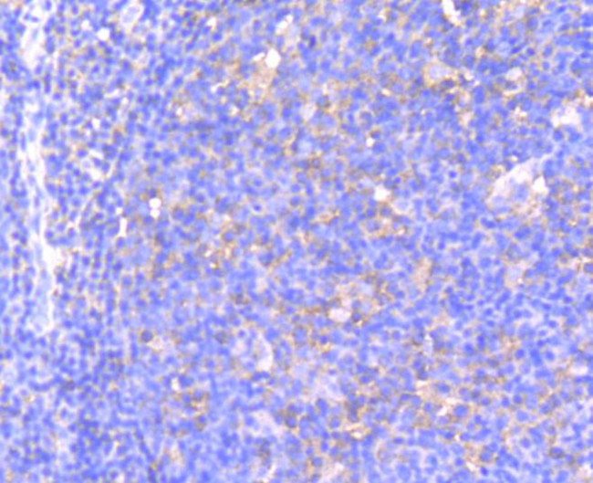 Phospho-MEK1 (Ser218, Ser222) Antibody in Immunohistochemistry (Paraffin) (IHC (P))