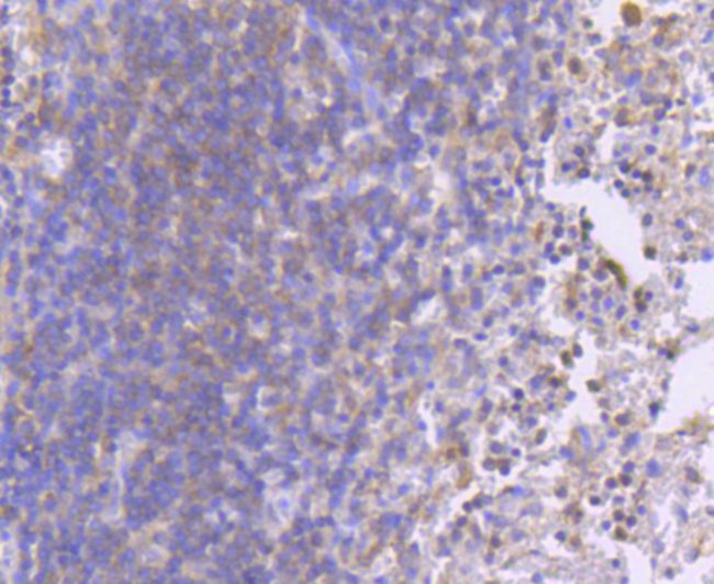 Phospho-MEK1 (Ser218, Ser222) Antibody in Immunohistochemistry (Paraffin) (IHC (P))