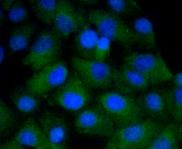 CD4 Antibody in Immunocytochemistry (ICC/IF)