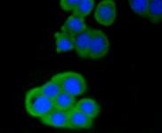 CD4 Antibody in Immunocytochemistry (ICC/IF)