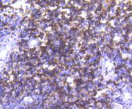 CD4 Antibody in Immunohistochemistry (Paraffin) (IHC (P))