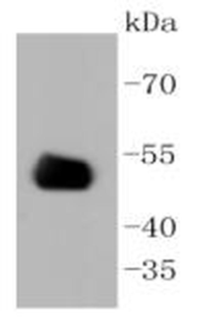 CD4 Antibody in Western Blot (WB)