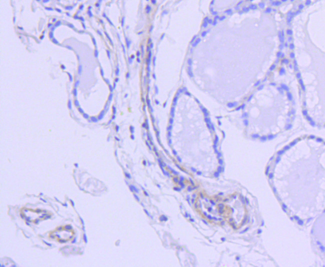 ROCK1 Antibody in Immunohistochemistry (Paraffin) (IHC (P))