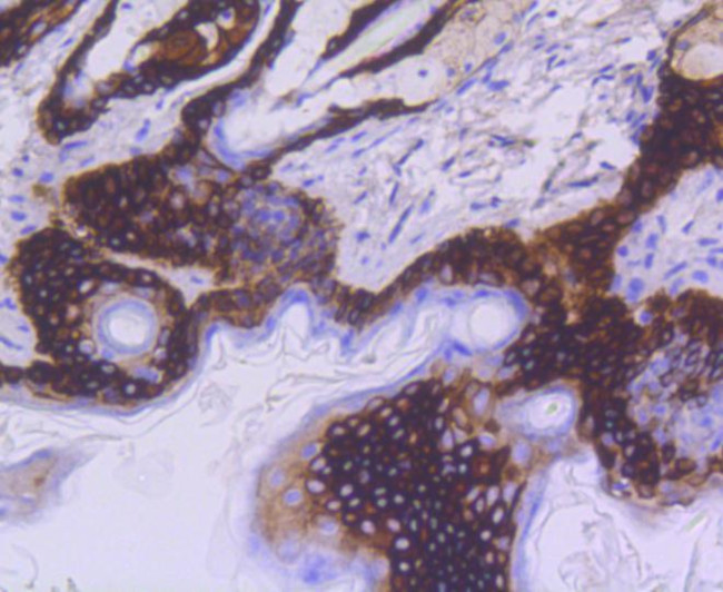 Cytokeratin 15 Antibody in Immunohistochemistry (Paraffin) (IHC (P))