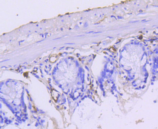 Cytokeratin 15 Antibody in Immunohistochemistry (Paraffin) (IHC (P))