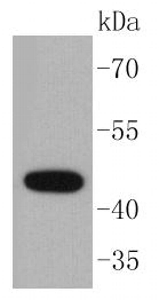 Cytokeratin 15 Antibody in Western Blot (WB)