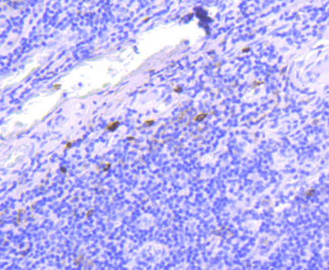 Human IgG4 Antibody in Immunohistochemistry (Paraffin) (IHC (P))