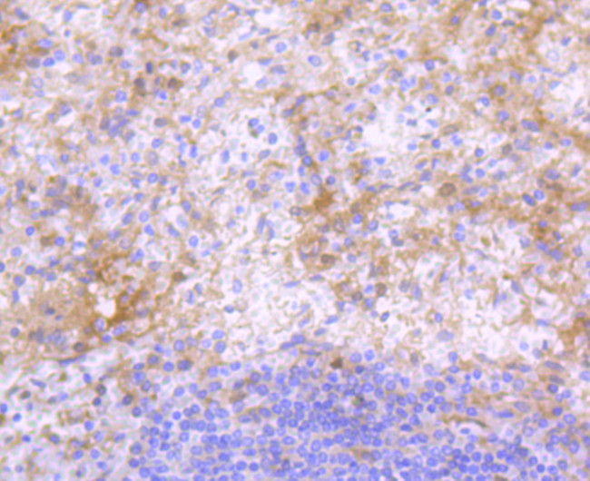 Human IgG4 Antibody in Immunohistochemistry (Paraffin) (IHC (P))