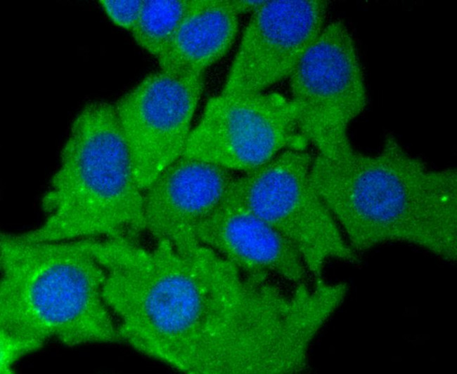 Cytokeratin 7 Antibody in Immunocytochemistry (ICC/IF)