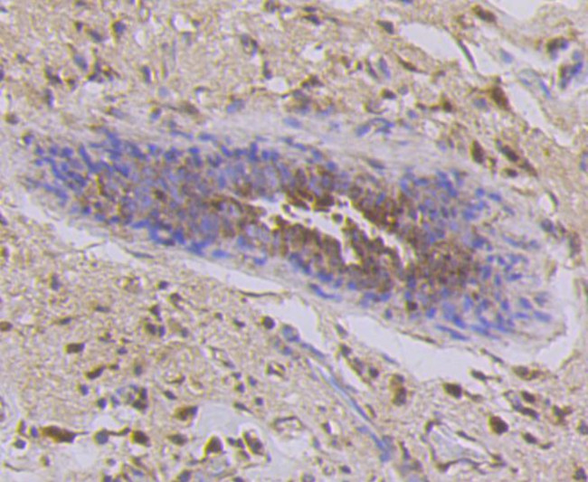 Cytokeratin 7 Antibody in Immunohistochemistry (Paraffin) (IHC (P))