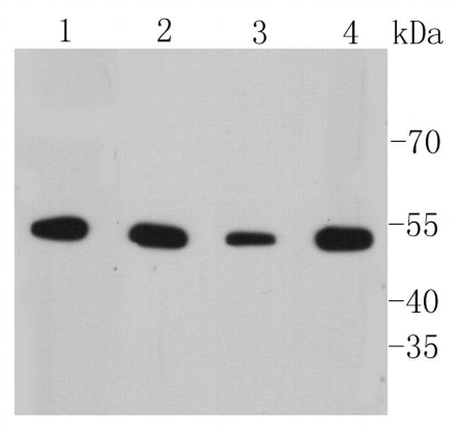 Cytokeratin 7 Antibody in Western Blot (WB)