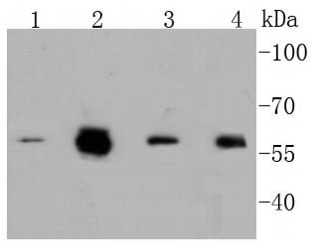 Phospho-c-Myc (Ser62) Antibody in Western Blot (WB)