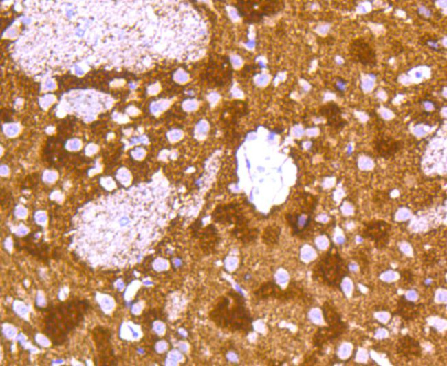 Synuclein alpha/beta Antibody in Immunohistochemistry (Paraffin) (IHC (P))