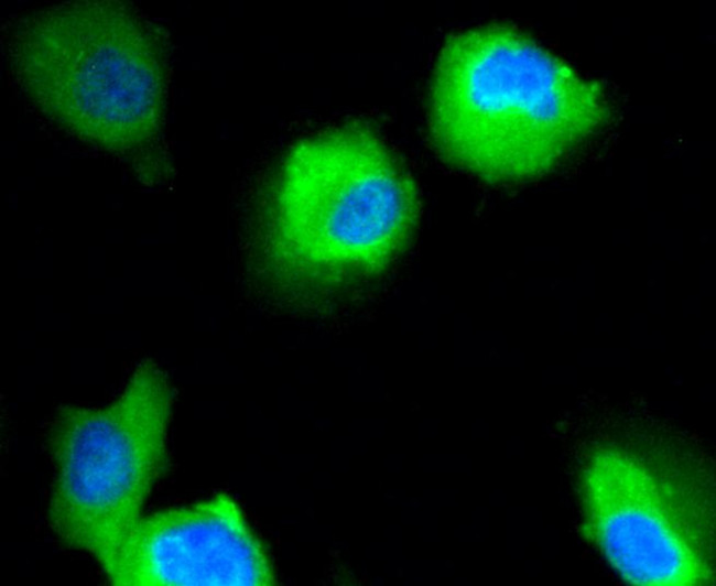 CD304 (Neuropilin-1) Antibody in Immunocytochemistry (ICC/IF)