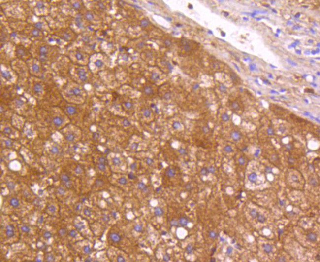 CD304 (Neuropilin-1) Antibody in Immunohistochemistry (Paraffin) (IHC (P))