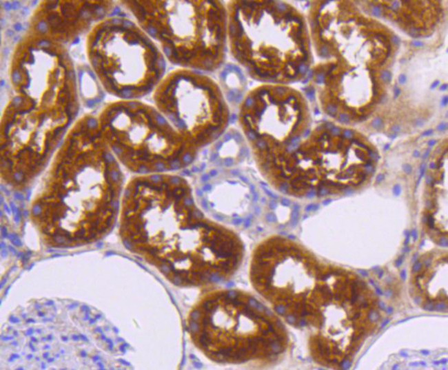 CD304 (Neuropilin-1) Antibody in Immunohistochemistry (Paraffin) (IHC (P))