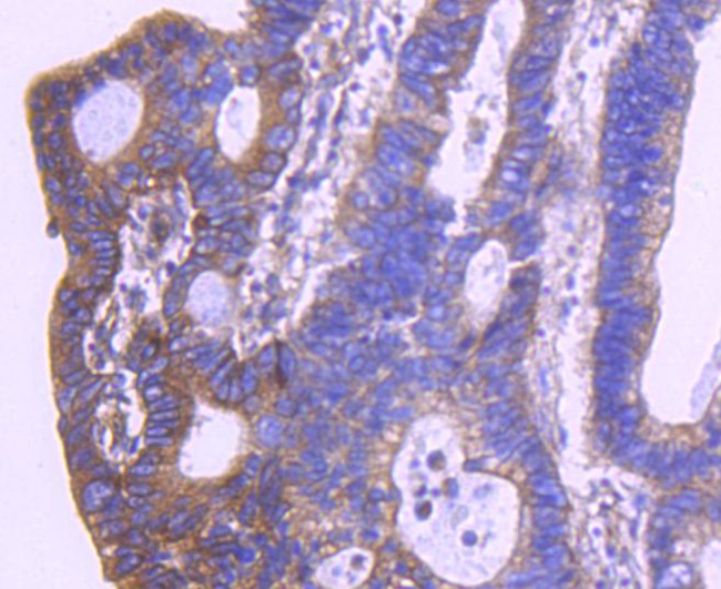 HTRA2 Antibody in Immunohistochemistry (Paraffin) (IHC (P))