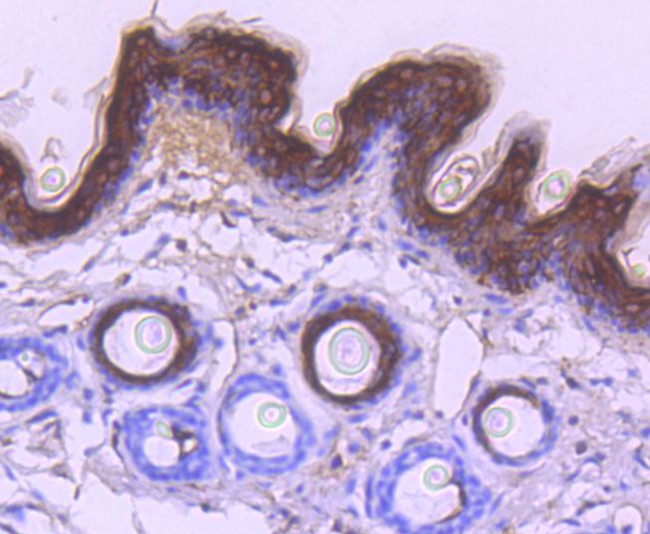 Cytokeratin 10 Antibody in Immunohistochemistry (Paraffin) (IHC (P))