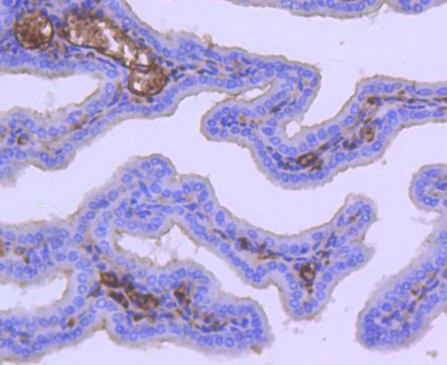 Acetyl-CoA Carboxylase Antibody in Immunohistochemistry (Paraffin) (IHC (P))