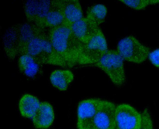 Musashi-2 Antibody in Immunocytochemistry (ICC/IF)