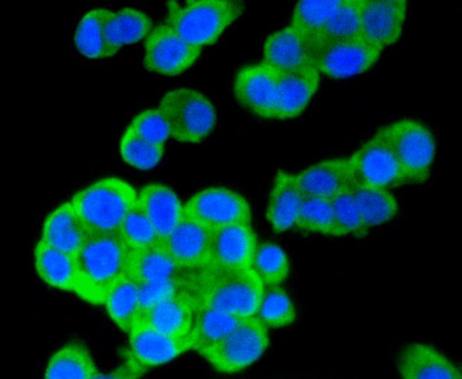 Musashi-2 Antibody in Immunocytochemistry (ICC/IF)