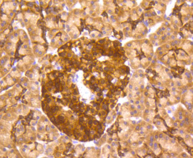 Musashi-2 Antibody in Immunohistochemistry (Paraffin) (IHC (P))