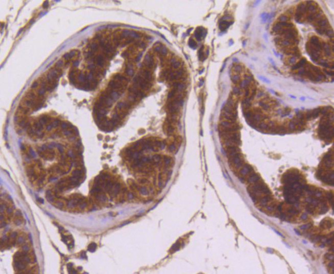 Musashi-2 Antibody in Immunohistochemistry (Paraffin) (IHC (P))