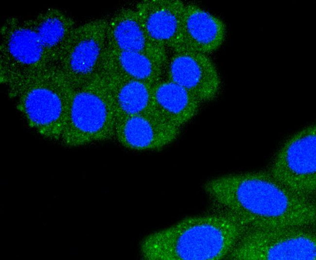 CD11a (LFA-1alpha) Antibody in Immunocytochemistry (ICC/IF)