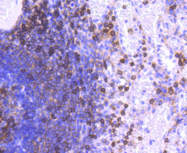 CD11a (LFA-1alpha) Antibody in Immunohistochemistry (Paraffin) (IHC (P))